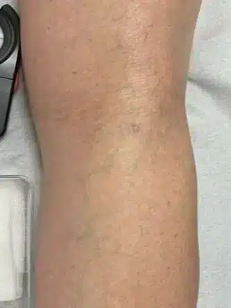 Imagen de antes de un tratamiento