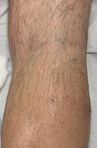 Imagen de antes de un tratamiento