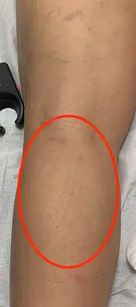 Imagen de después de un tratamiento