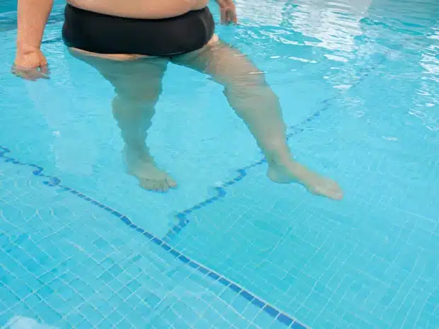 Person with obesity doing gentle exercise in a therapeutic pool
