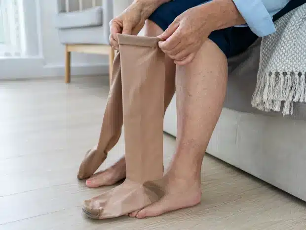 Compression stockings prepared for use in venous problems